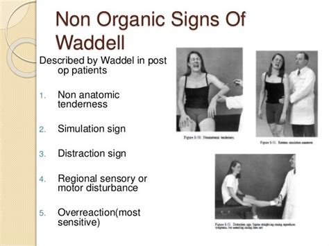 waddell's distraction test results